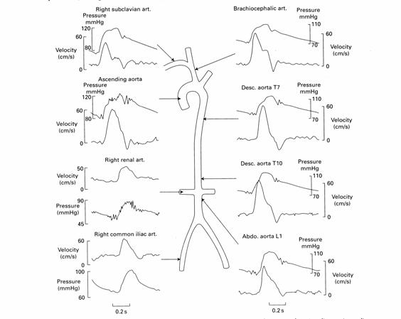 arteries of body diagram. human ody. Diagram of the
