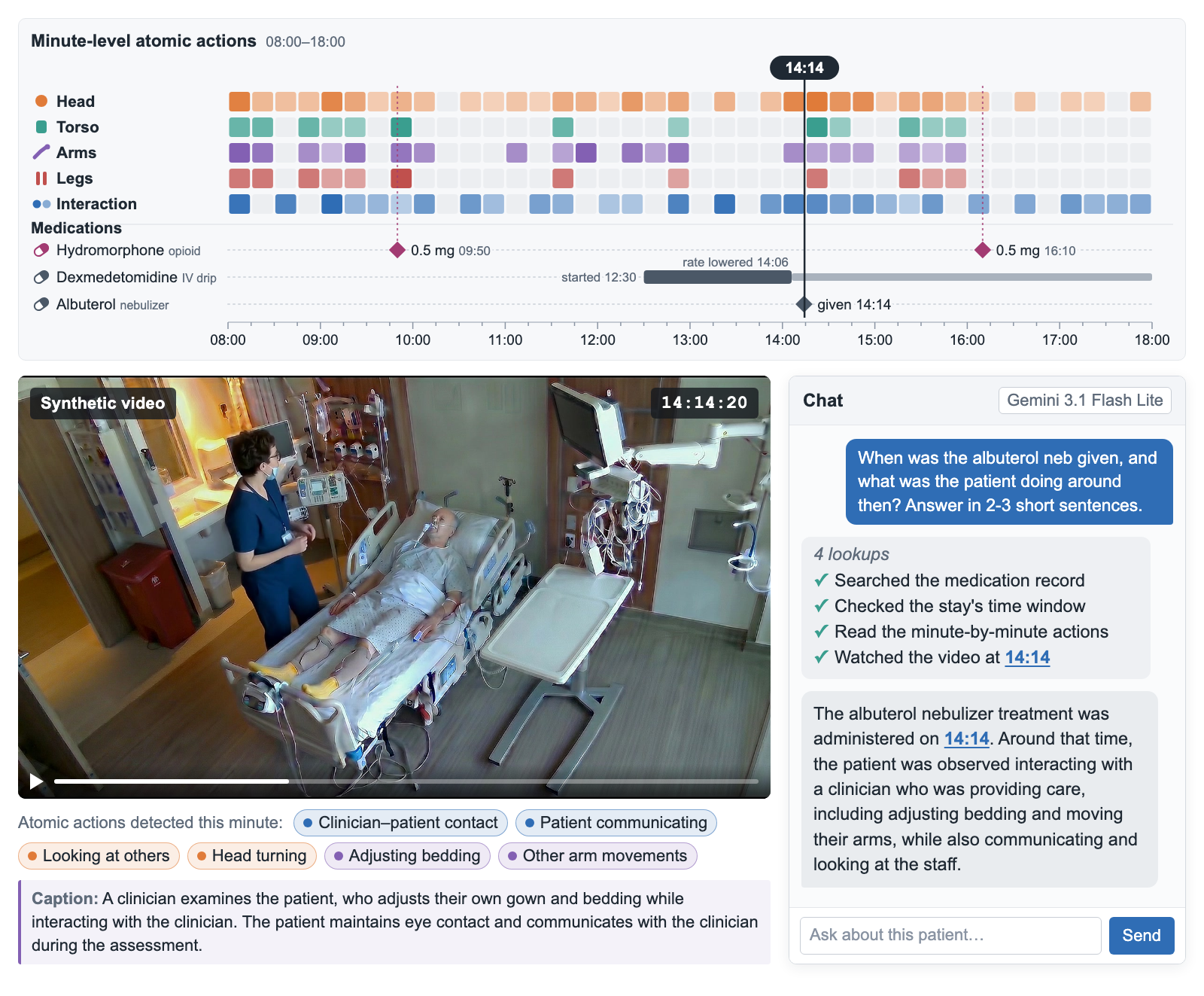 The TRACER viewer on synthetic data. Top: a timeline from 08:00 to 18:00 of minute-level atomic actions grouped into head, torso, arms, legs and interaction, above medication rows for hydromorphone, dexmedetomidine and albuterol, with a cursor at 14:14. Bottom left: a synthetic ICU video frame at 14:14:20 showing a clinician beside a patient in bed, with the atomic actions detected that minute and a one-sentence caption below it. Bottom right: a chat panel where the user asks when the albuterol nebulizer was given and what the patient was doing; the assistant lists four lookups and answers with a clickable 14:14 timestamp.